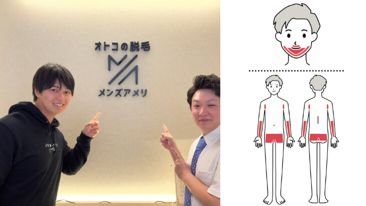 口コミボード写真