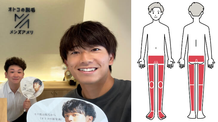 口コミボード写真